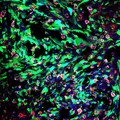 Nanoparticles in the Brain