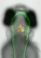Zebrafish Model of Melanoma Tumor Invasion