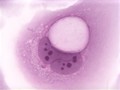 Human Foreskin Koilocytes