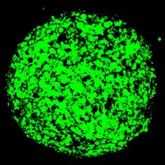 Mesothelioma Spheroid: Image Details - NCI Visuals Online