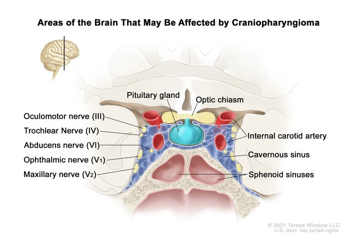 Breast, Male, Anatomy: Image Details - NCI Visuals Online