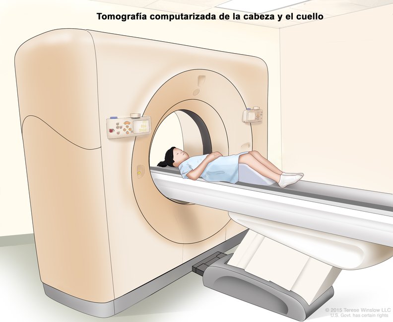 Tomografia Computarizada Tc De La Cabeza Y El Cuello Scan Computed Tomography Head And Neck Child Image Details Nci Visuals Online