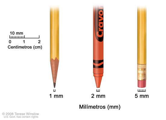 partido Democrático Preludio esquema Milímetros (Mole Size - Millimeter): Image Details - NCI Visuals Online
