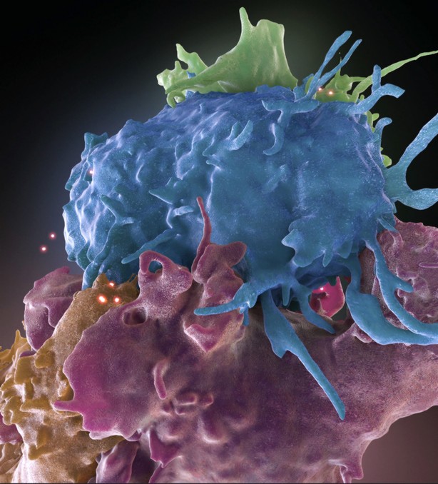 nfección por VIH y el riesgo de cáncer