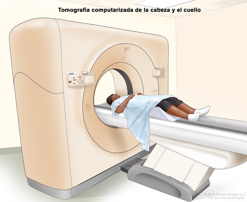 Tomografía Computarizada (TC) de la Cabeza y el Cuello Computed Tomography, Head And Neck): Image - NCI Visuals Online