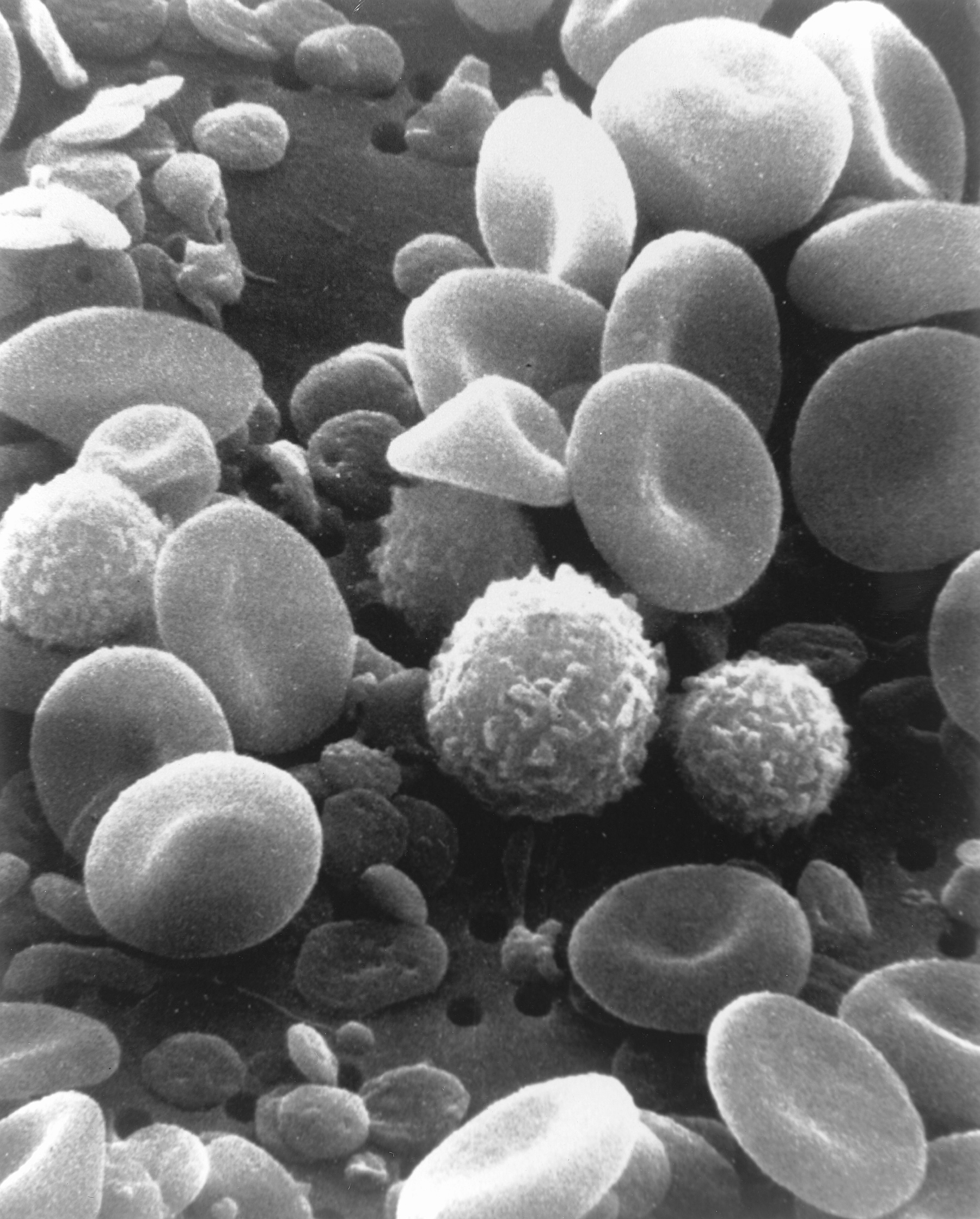 refrigerator Begging Mention Scanning Electron Microscope Image of Blood Cells: Image Details - NCI  Visuals Online